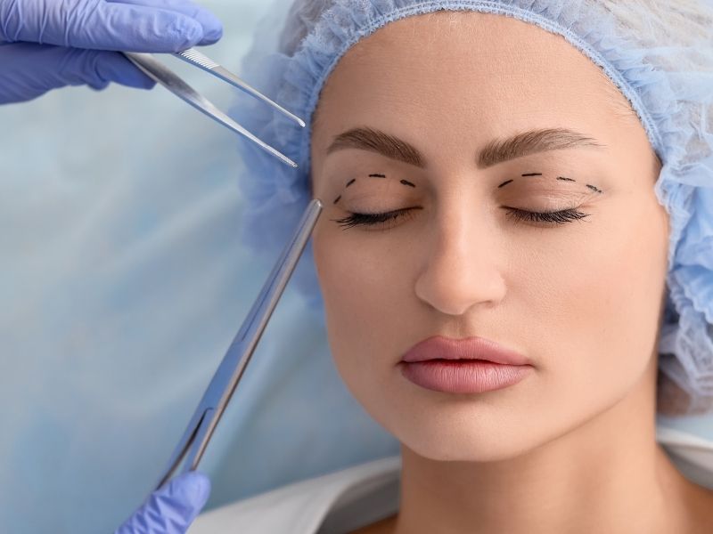 Blefaroplastia moderna em Sao Paulo quando indicar e quais sao os avancos da cirurgia das palpebras
