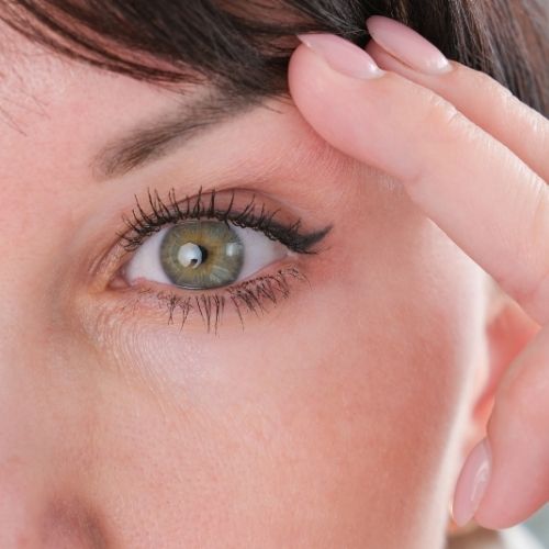 Cirurgia Plastica de Blefaroplastia em Sao Paulo 1