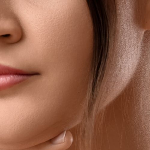 Cirurgia Plastica de Lifting do Terco Medio em Sao Paulo