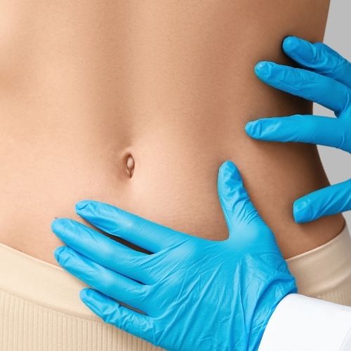 Cirurgia Plastica de Lipoaspiracao em Sao Paulo