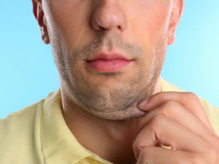 Especialista em lipo de papada em São Paulo