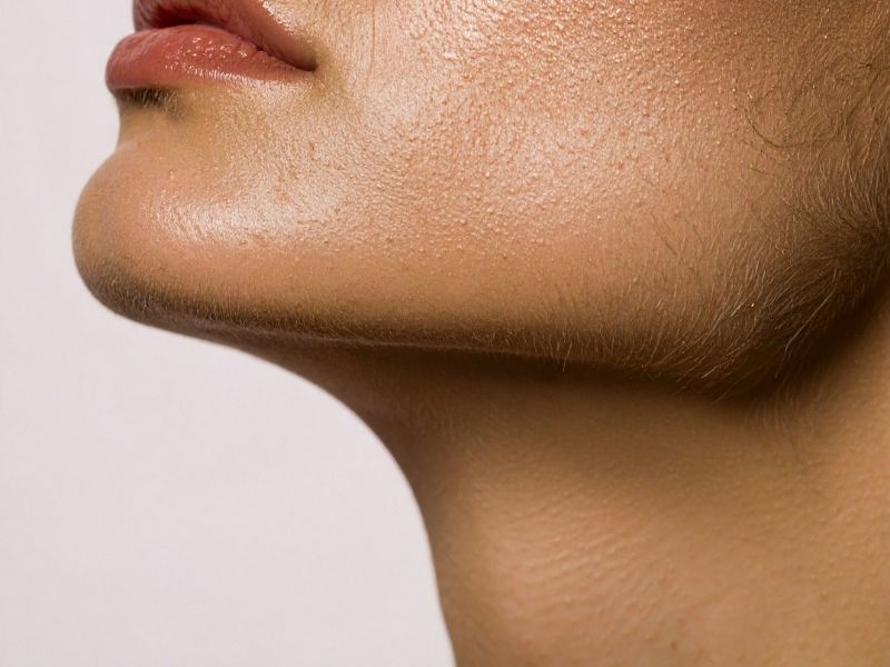 Rejuvenescimento do pescoço São Paulo